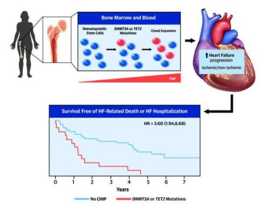 血細(xì)胞突變會(huì)加速心力衰竭的進(jìn)展