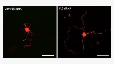 新藥可以再生前列腺手術(shù)損傷的勃起神經(jīng)