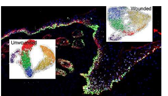 一項(xiàng)新研究揭示了皮膚細(xì)胞如何準(zhǔn)備好治愈傷口