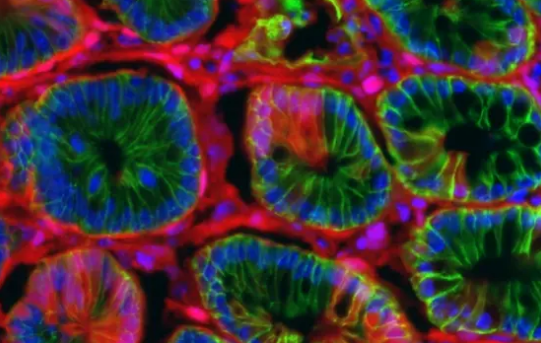 加速結腸癌研究的新模型