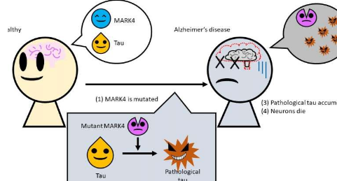 阿爾茨海默氏病的原因可追溯到常見(jiàn)酶的突變
