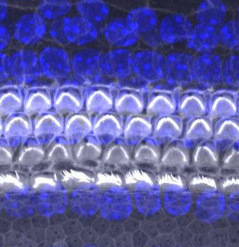 研究人員確定蛋白質(zhì)在新的聽力毛細(xì)胞發(fā)育中的作用