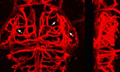 在發(fā)育過程中發(fā)現(xiàn)腦血管尋路的機制