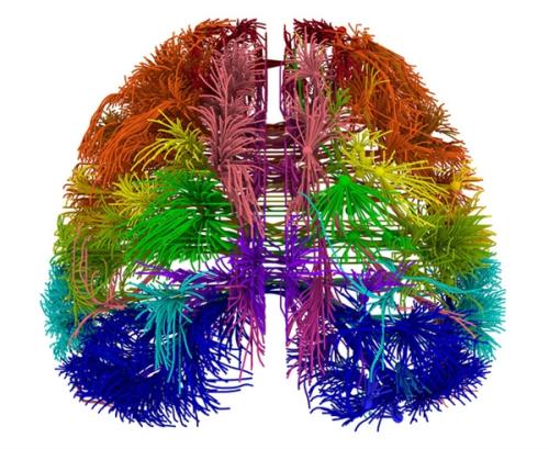 研究發(fā)現(xiàn)新基因可能推動最早的大腦改變