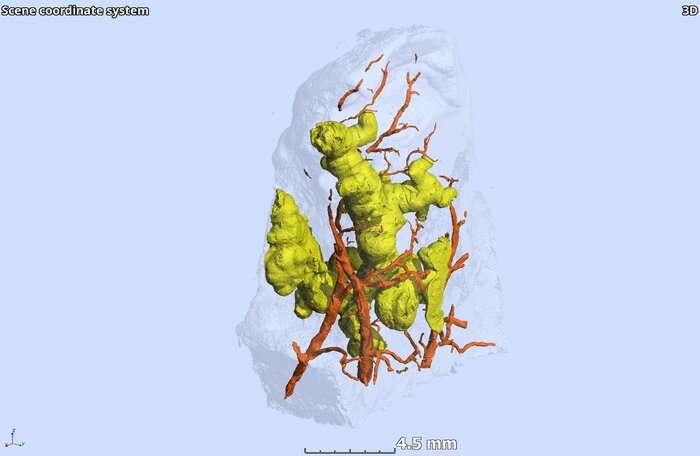 結(jié)核病肉芽腫的第一個3-D視圖改變了它們的形狀和形成的范式