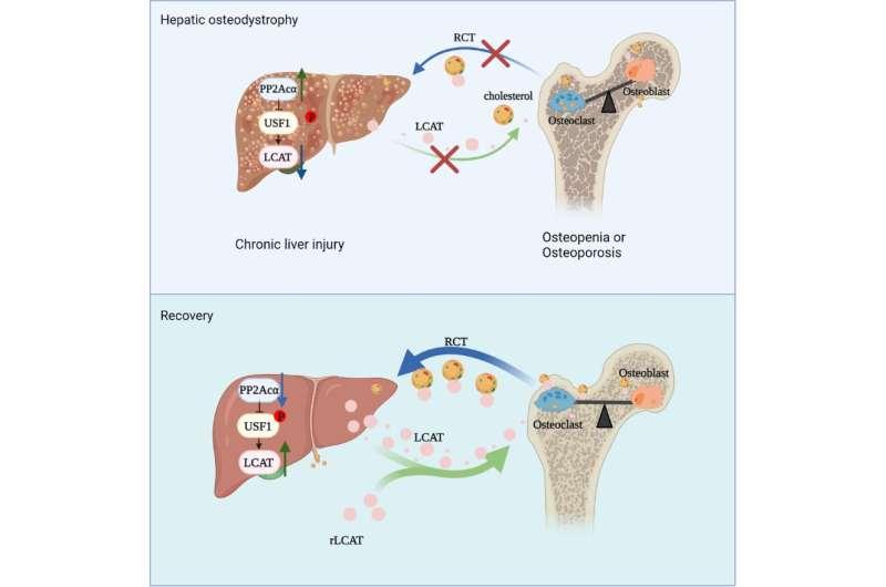 3月2日科學(xué)家揭示慢性肝損傷如何導(dǎo)致骨質(zhì)流失