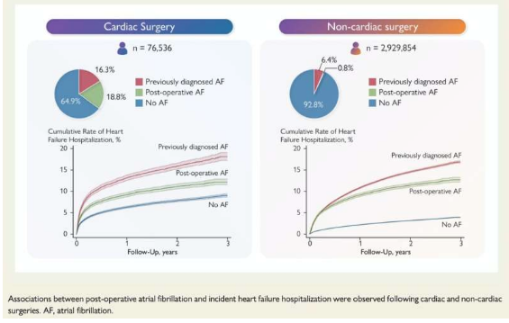 手術(shù)后心房顫動(dòng)與心力衰竭住院風(fēng)險(xiǎn)增加有關(guān)