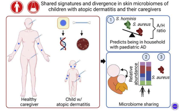 特應(yīng)性皮炎兒童與健康接觸者共享皮膚微生物群可能導(dǎo)致復(fù)發(fā)