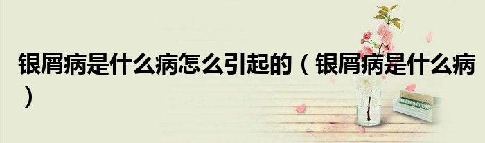 銀屑病是什么病怎么引起的（銀屑病是什么?。?class='thumb lazy' /></a>
		    <header>
		<h2><a  href=