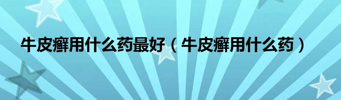 牛皮癬用什么藥最好（牛皮癬用什么藥）
