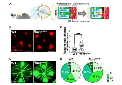 RORα 的遺傳缺陷和藥理學調節(jié)調節(jié)激光誘導的脈絡膜新生血管形成