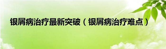 銀屑病治療最新突破（銀屑病治療難點）