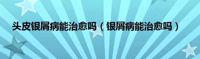 頭皮銀屑病能治愈嗎（銀屑病能治愈嗎）