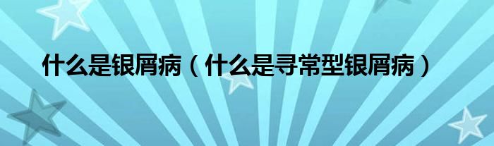 什么是銀屑?。ㄊ裁词菍こＰ豌y屑病）