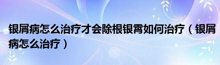 銀屑病怎么治療才會除根銀霄如何治療（銀屑病怎么治療）