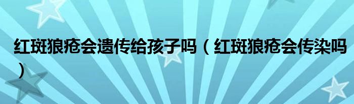 紅斑狼瘡會(huì)遺傳給孩子嗎（紅斑狼瘡會(huì)傳染嗎）