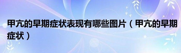 甲亢的早期癥狀表現(xiàn)有哪些圖片（甲亢的早期癥狀）