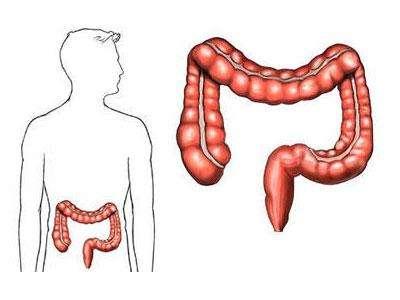 關于結腸癌的9個事實