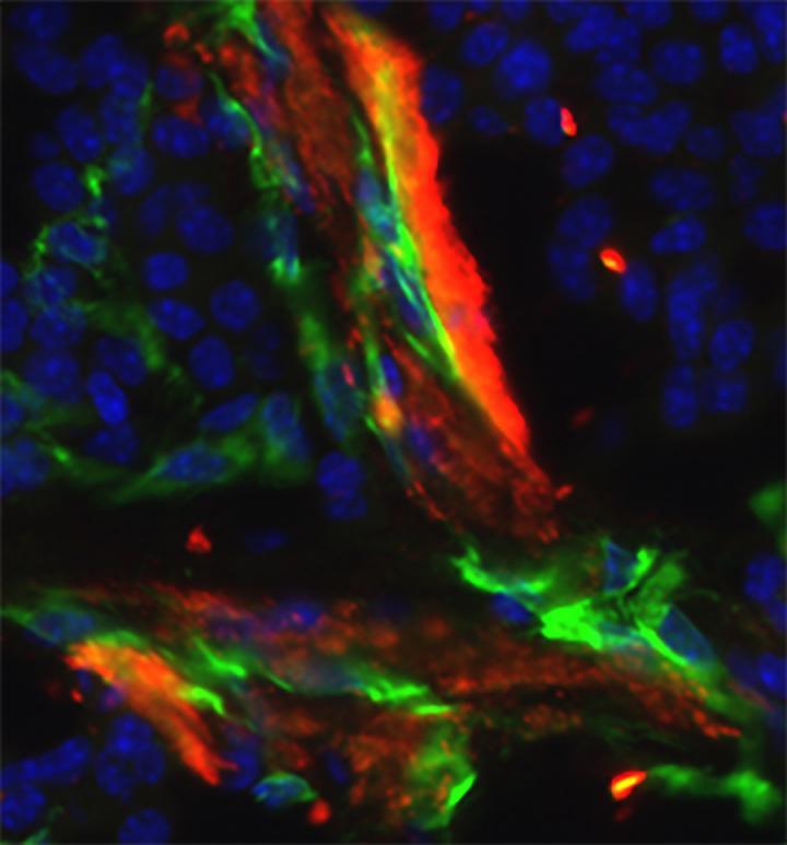 研究人員發(fā)現(xiàn)血小板在腫瘤血管中的新功能